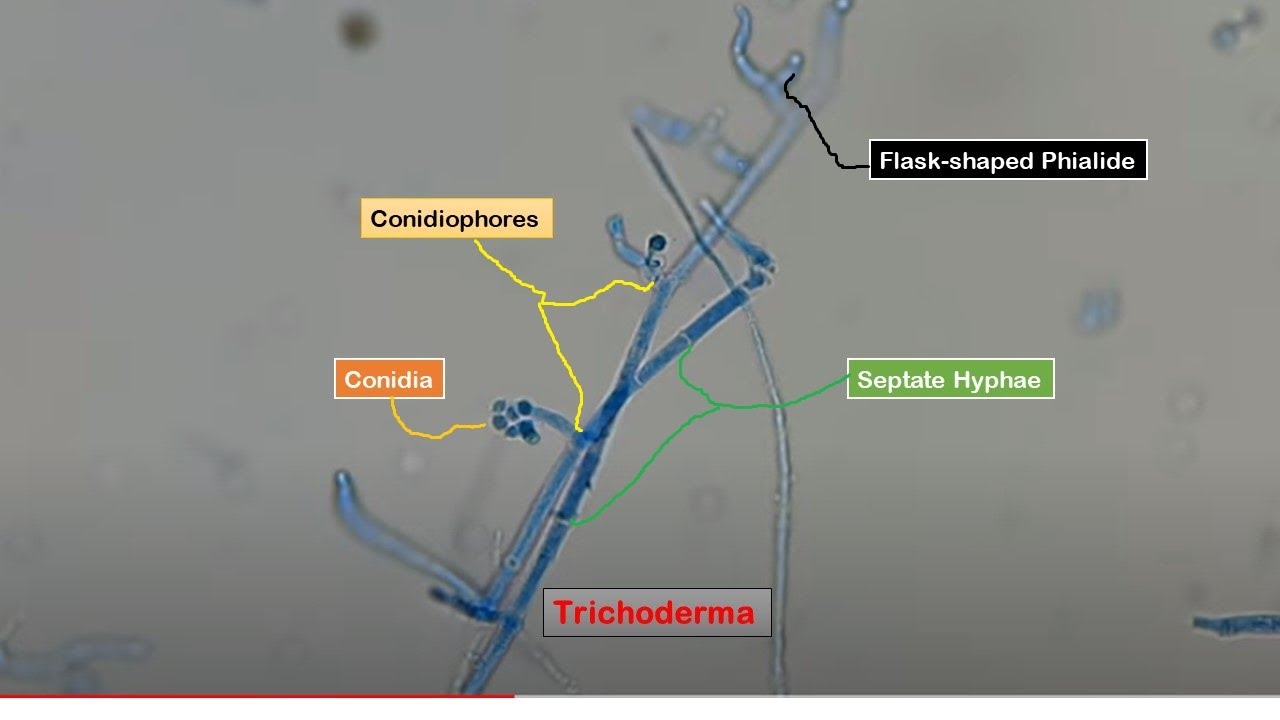 conidia-phialides-and-conidiophores-of-trichoderma-in-lpcb-preparation