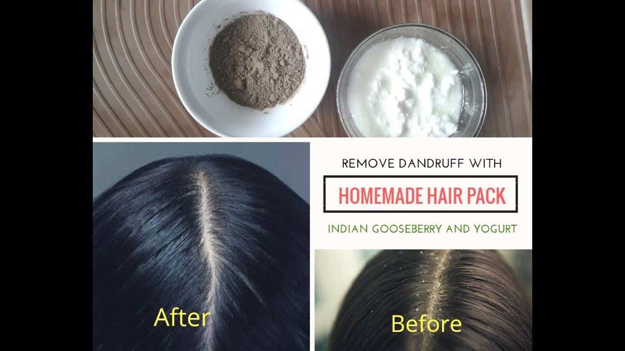 Homemade Hair Pack for Dandruff YouTube