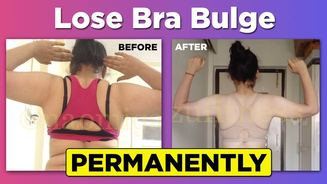 5 Methods for Back Fat and Bra Bulge Removal