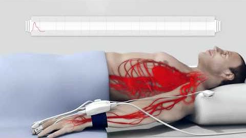 Edwards Lifesciences ClearSight System