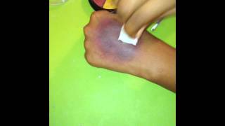 Special fx makeup tutorial:bruise