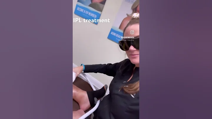 Lumecca IPL treatment for skin pigment irregularities