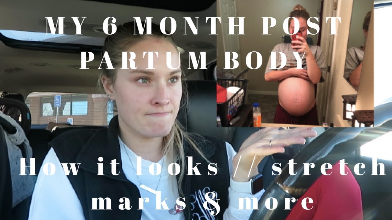 12 DAYS OF CHRISTMAS WHAT DOES 6 MONTH POST PARTUM BODY LOOK LIKE 