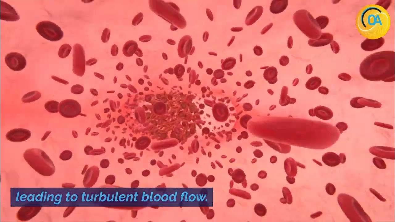 Why do i hear my heartbeat in my ear youtube