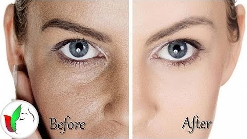 Get Rid of Large Pores- 4 best remedy Get Smooth, Tighter, Younger Looking Skin Video