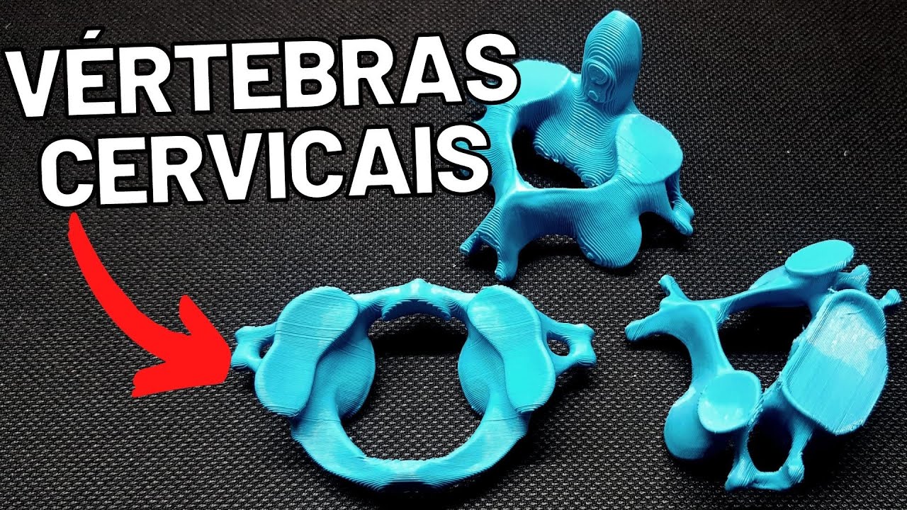 ANATOMIA  - Vertebras cervicais (peças anatômicas) - Acidentes ósseos!