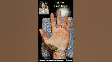 Thumbnail of Movements that make up Opposition of the Thumb