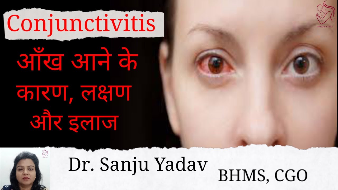  Conjunctivitis YouTube