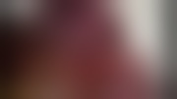 Lingulectomy VATS Biport (Not Edited) Segmentectomy VATS  (3cm utility incisioni + camera port)