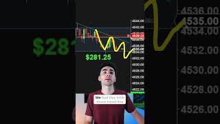 Are You Over Managing Your Trades?