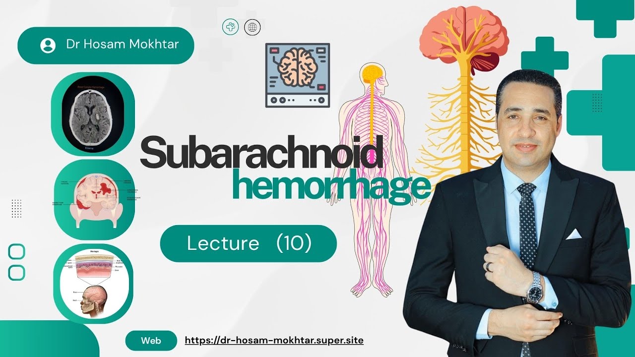 Neurology - Lecture 10 -Subarachnoid hemorrhage