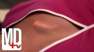 Download lagu Husband's Tracking Device Almost KILLS HER! | Royal Pains | MD TV