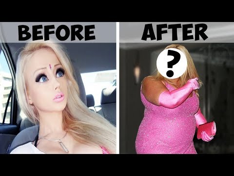 What Does Human Barbie Look Like 7 Years After Becoming Famous?