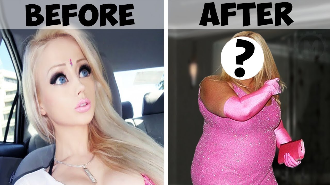 What Does Human Barbie Look Like 7 Years After Becoming Famous?