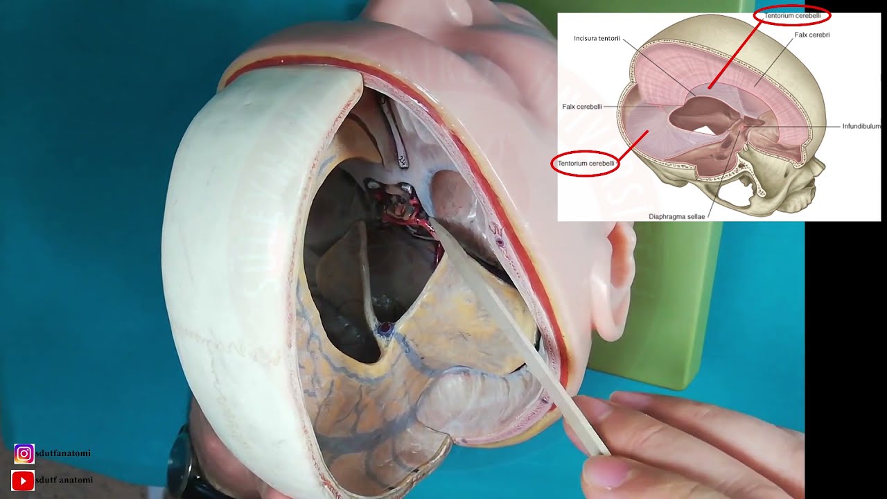 Meninges (Meninx: Dura Mater, Arachnoidea Mater, Pia Mater) Teorik ve Laboratuvar Dersi