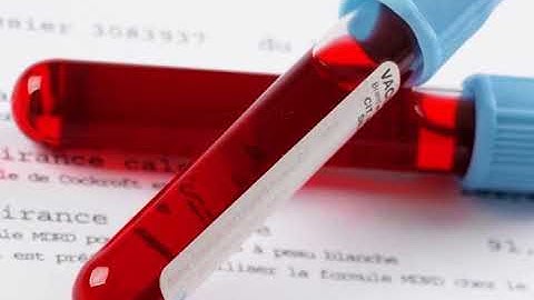 Post-mortem Interval – Part I (CH-06) #swayamprabha