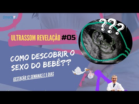 ULTRASSOM OBSTETRICO #05: Gravidez 12 semanas - Revelação sexo do bebê - menino ou menina?