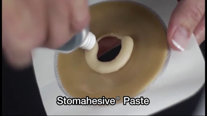 How to use Stomahesive® Paste