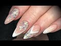 Acrylic nails - pink &amp; white design set with glitter