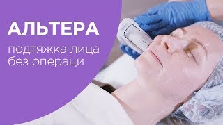 ULTHERA (Альтера) | Ультразвуковой SMAS лифтинг в Медиэстетик