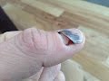 Construction Worker Fixes a Smashed Fingernail with Baking Soda and Superglue