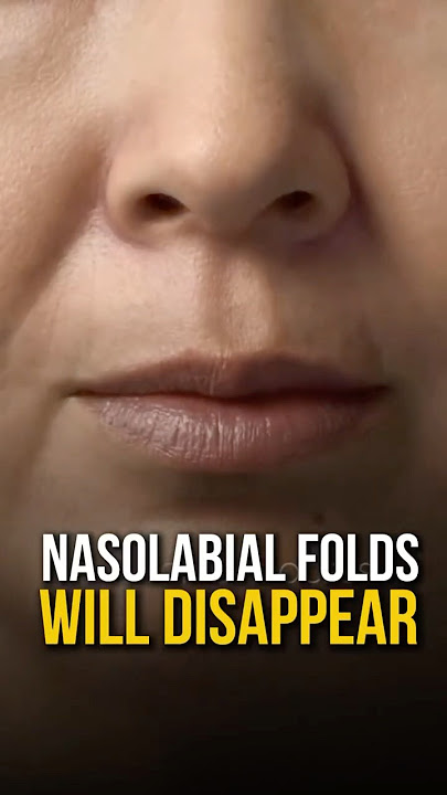 Nasolabial folds will disappear🔥 #faceyoga #facefitness #faceyoga #antiaging #wrinkles #laughlines