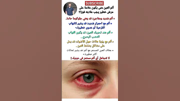 ألم العين متى يكون علامة على مرض خطير يجب علاجه فورا صحة معلومات طبية 