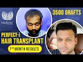 Hair transplant testimonial  most trusted hair transplant clinic in india delhi  medlinks