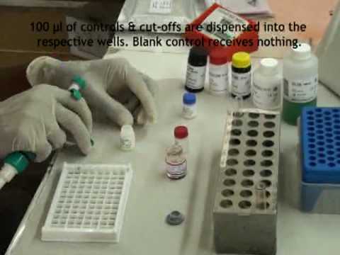 Videó: Monoklonális Antitest-alapú ELISA Módszer A Korábbi Dengue-fertőzés Diagnosztizálásában