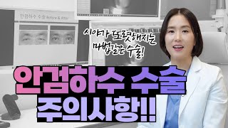 판교안과 안검하수 수술 주의사항!