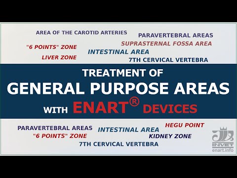 Treatment Of General Purpose Areas With ENART Devices 