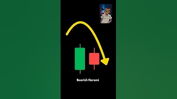 "Top 5 Chart Patterns Every Trader Misses 😱 | Secret Pattern That Works 90% Times | Day 13 Trading"