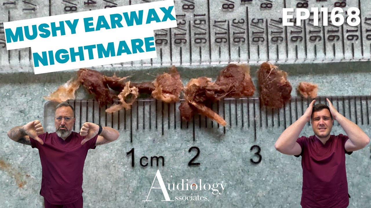 Набор для глубокого удаления ушной серы, микроотсоса и ирригации - EP1169