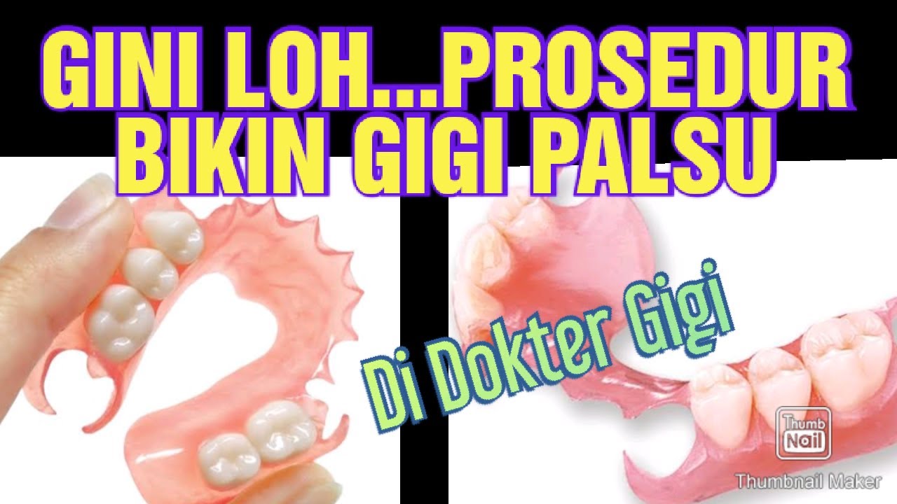 PROSES PEMBUATAN GIGI PALSU UNTUK PASIEN