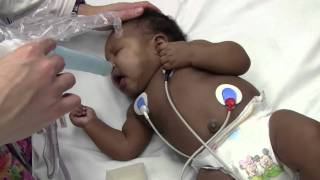 Two RSV Patients