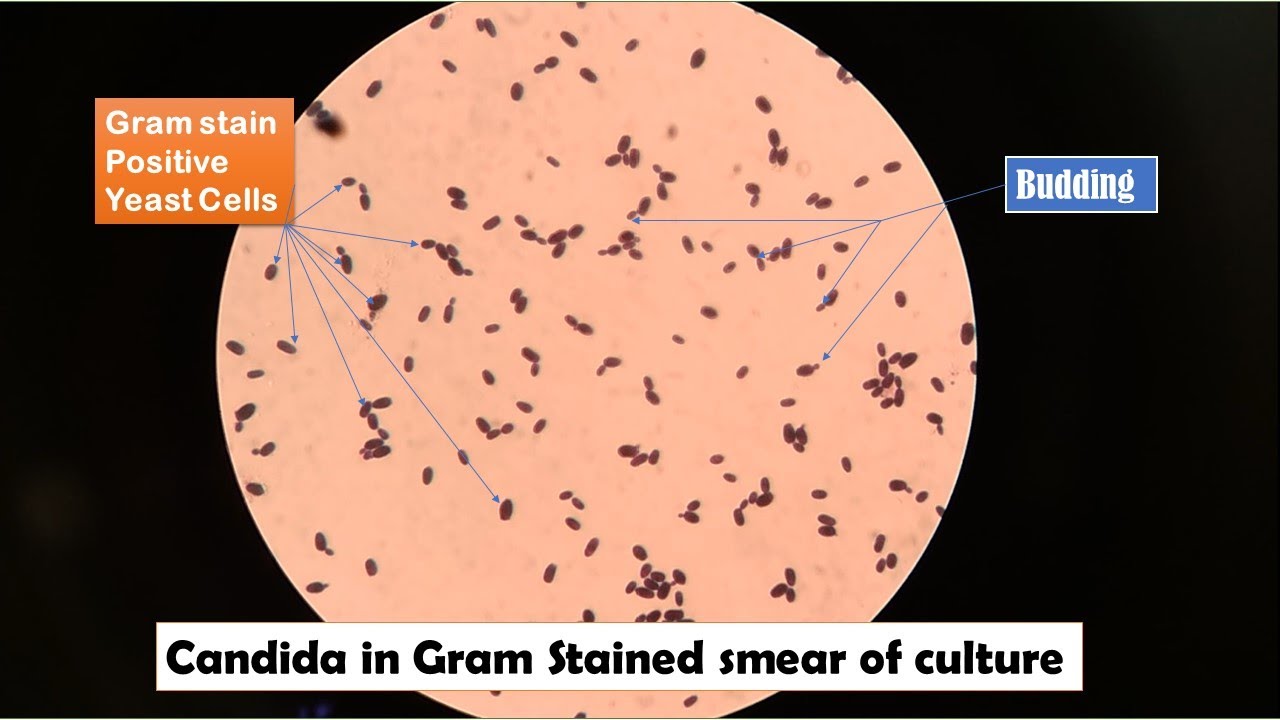 budding yeast gram stain