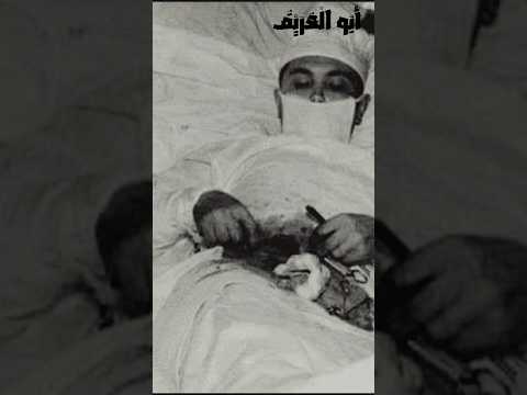 أخطر عملية في التاريخ من غير دكتور