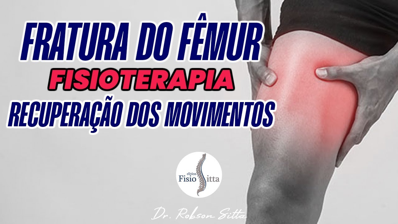 FRATURA DIAFISÁRIA DO FÊMUR - RECUPERAÇÃO FISIOTERAPIA PÓS OPERATÓRIO Dr. Robson Sitta
