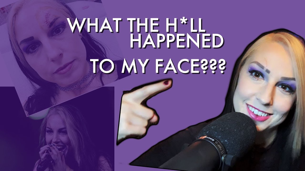 What The H*LL happened to my FACE?! - YouTube