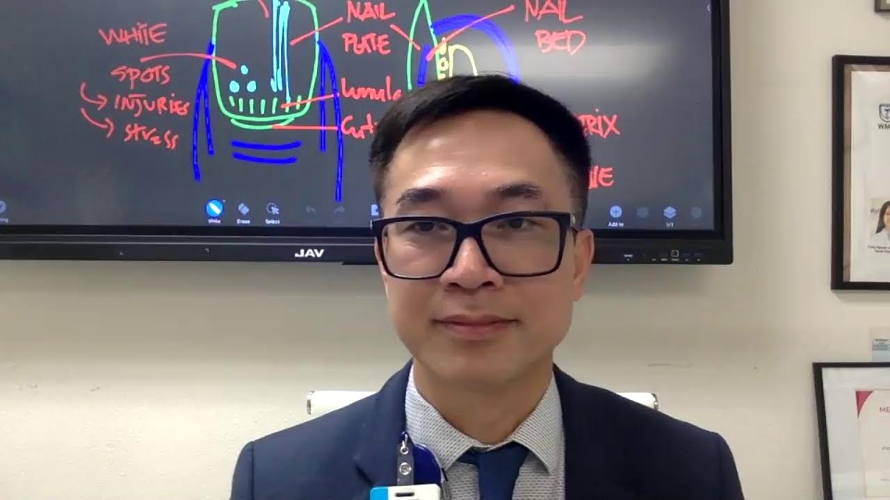 #579. Vạch đen móng tay hay đốm trắng ở móng tay là bệnh gì?