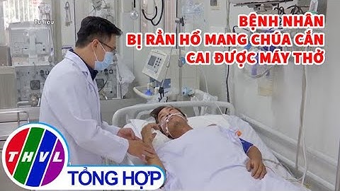 Bệnh nhân bị rắn hổ mang chúa cắn được cai máy thở