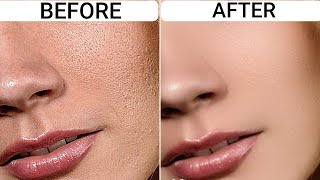 For some people, seeing uneven patches or over-sized pores can be a
frustrating. skin texture is essentially measure of how smooth your
feels. wi...