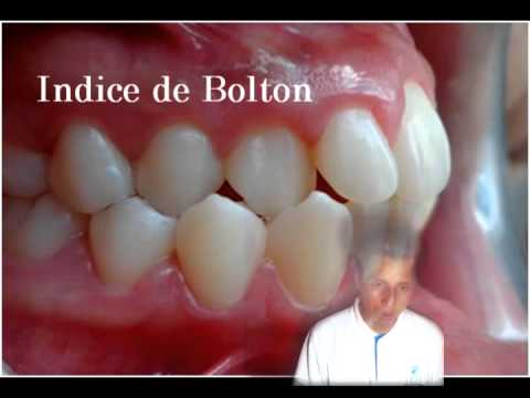 analisis de modelos en ortodoncia
