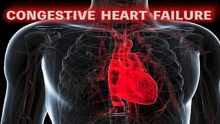 Congestive Heart Failure (updated 2021) - CRASH! Medical Review Series