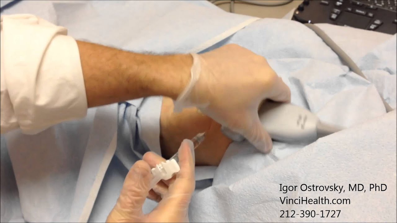 Hyaluronic Acid Injection to the Knee Joint 1 YouTube