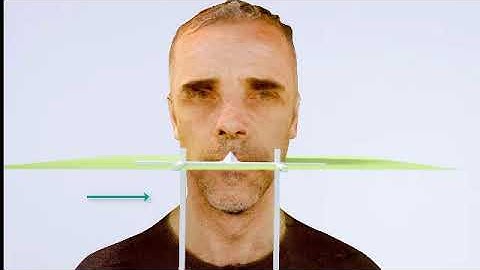 Digital FaceBow Method by Logicdent