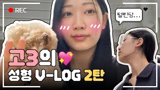 고3의 안면윤곽 브이로그 2편 l 안면윤곽 3종 + 코 성형후기