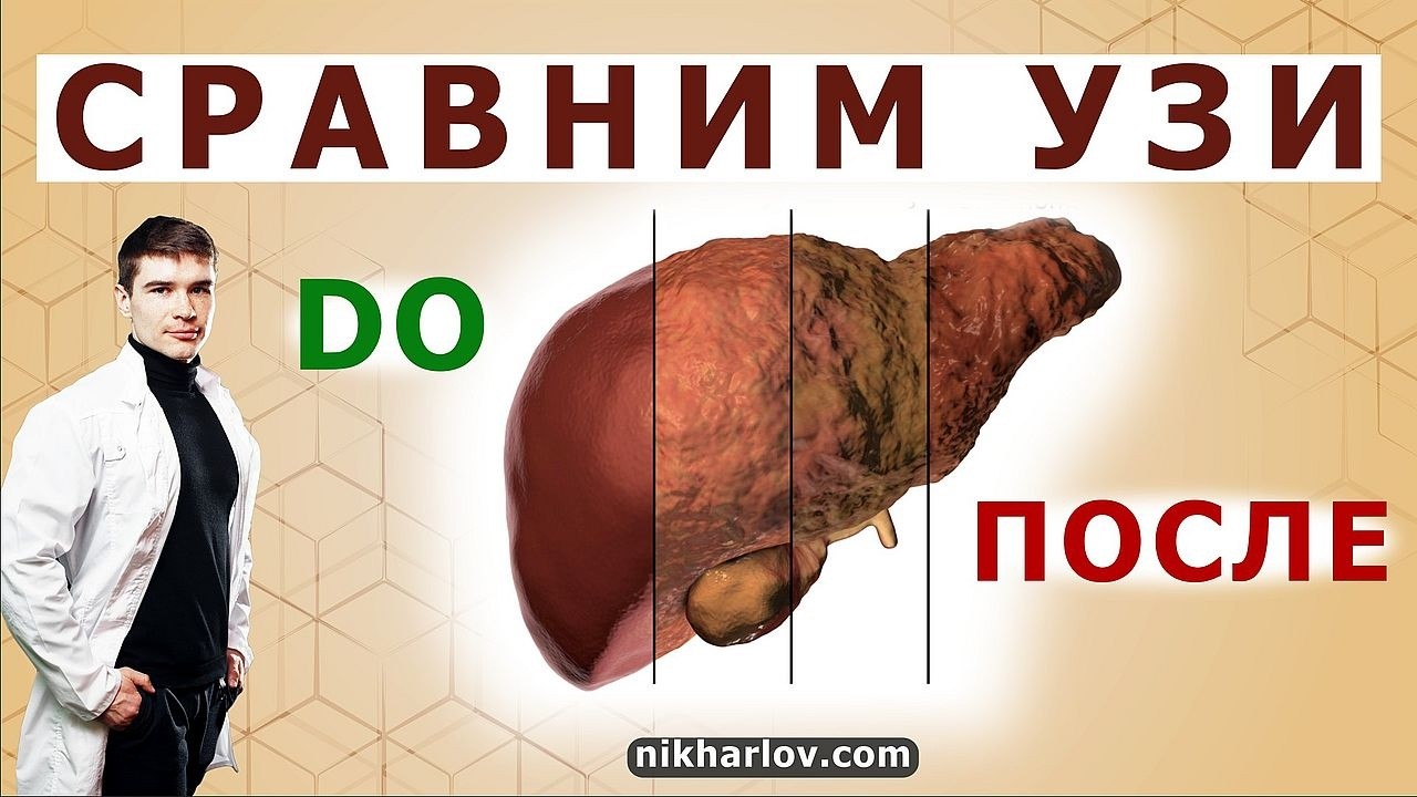 УЗИ расшифровка: внутренние органы на высокоуглеводном питании и на низкоуглеводной кето диете.