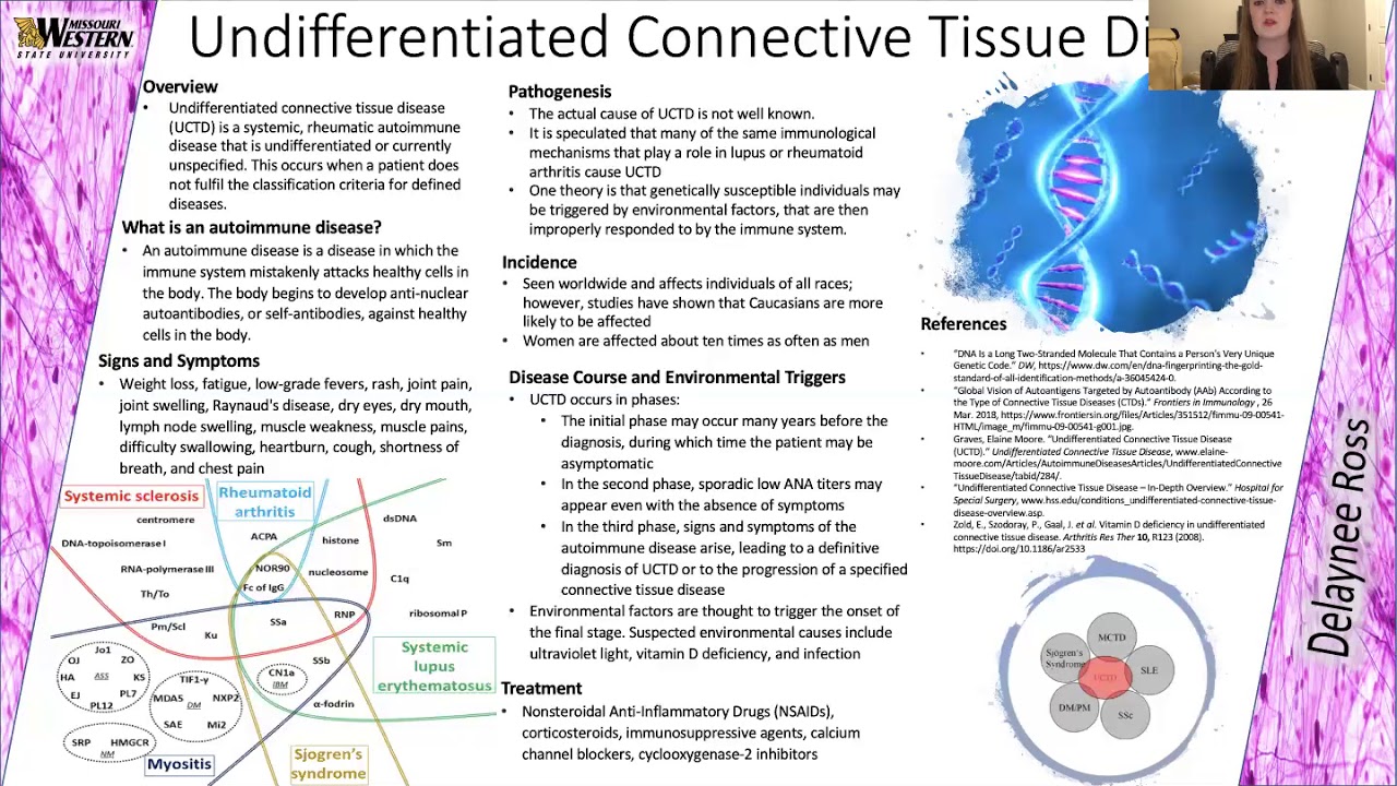 Undifferentiated Connective Tissue Disease (UCTD) - YouTube