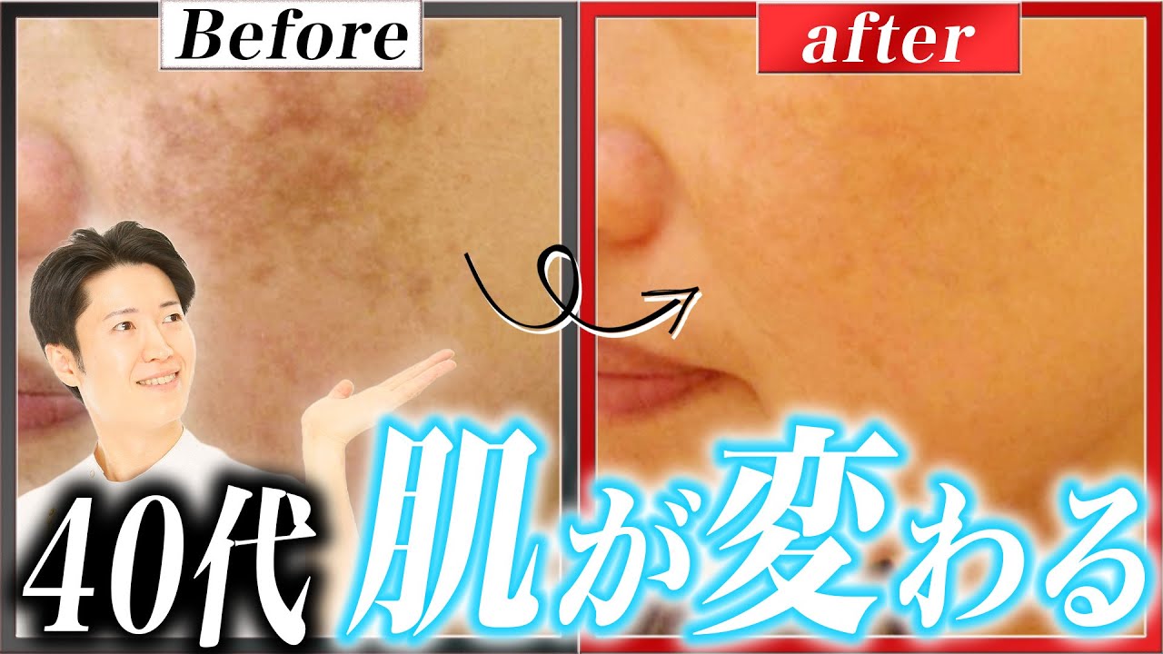 【40代からの美肌習慣】シミ・毛穴を増やさない「毎日ルーティン」を全部話します！